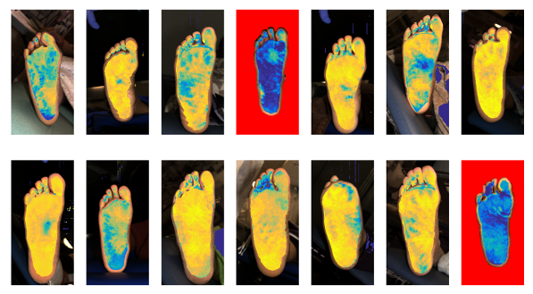 Microvascular insights empower clinicians to manage patients with potential circulatory compromise.