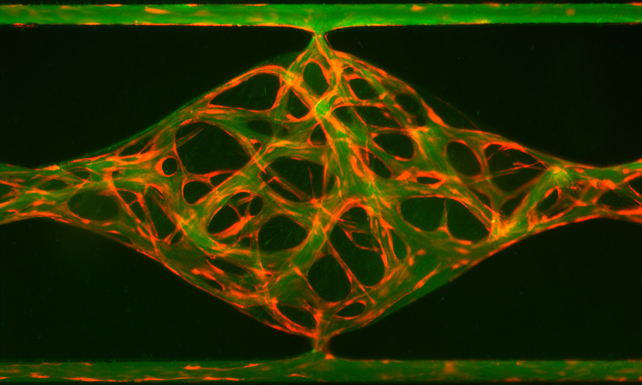Aracari’s VMO™ platform is ideal for understanding the physiological responses of vessels to pro- and anti-angiogenic therapies.